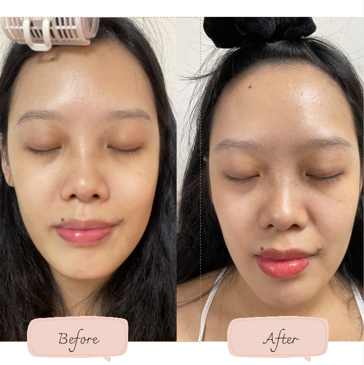 20251113-i3yg9 20251113-i3yg9